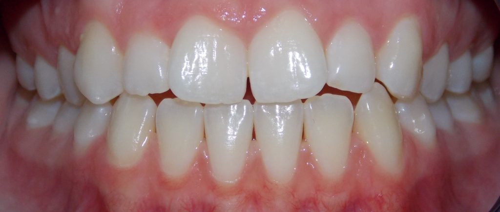 Before Image - Case by Dr Khetarpal 