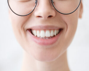 Smile Brighter: The Benefits of White Fillings